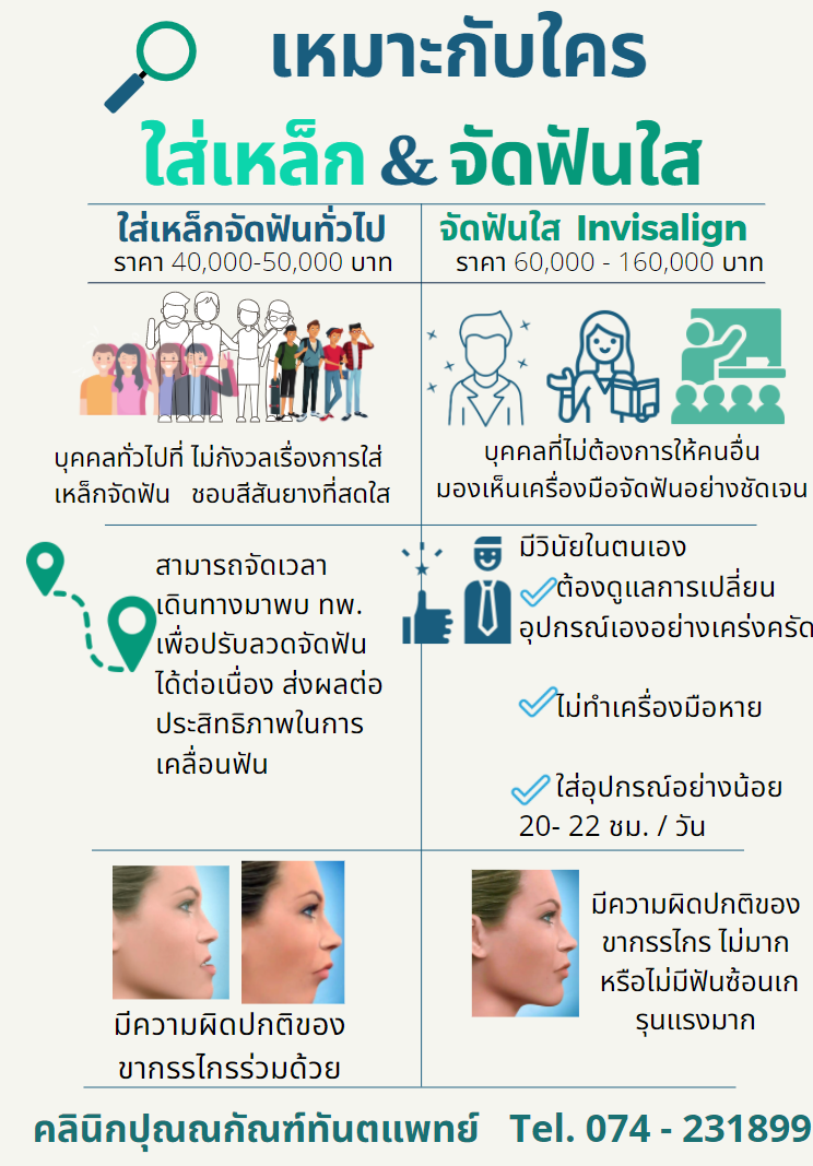 การจัดฟันใส หาดใหญ่