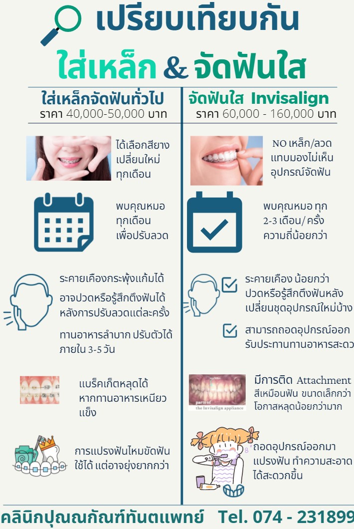 การจัดฟันใส หาดใหญ่