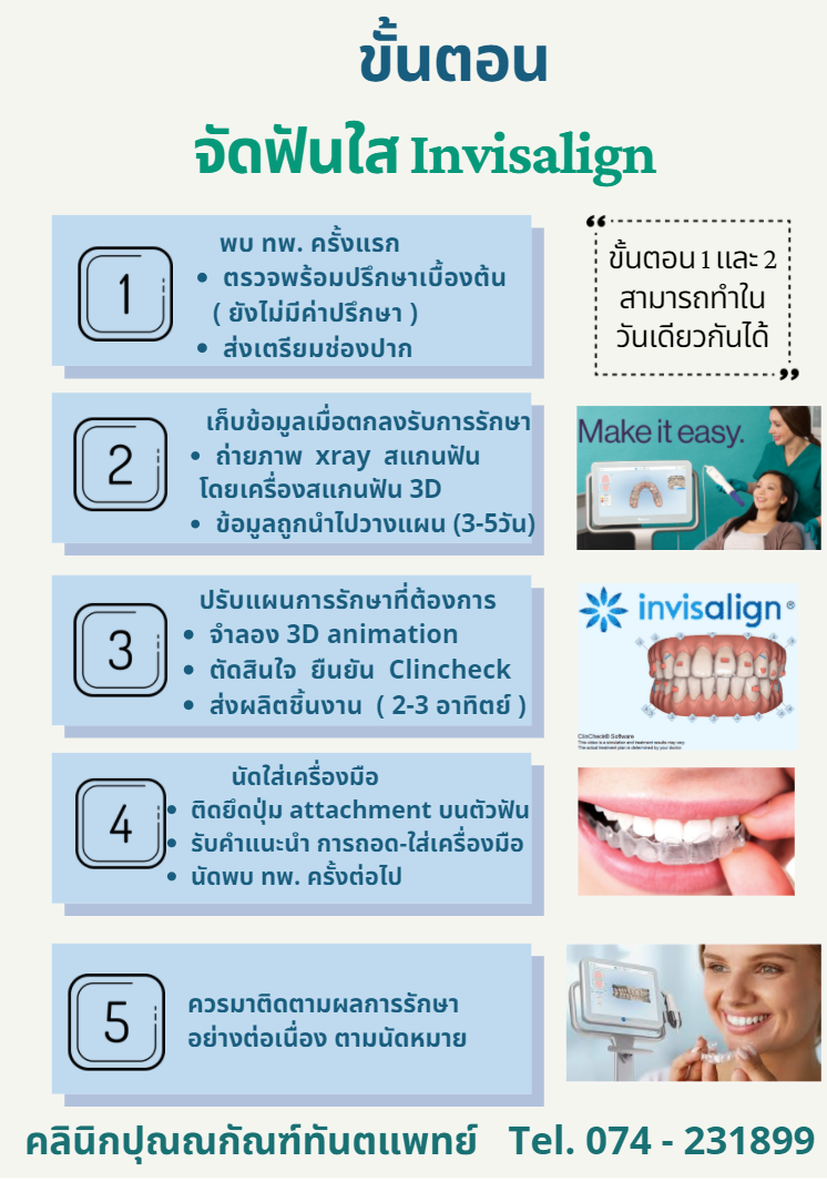 การจัดฟันใส หาดใหญ่