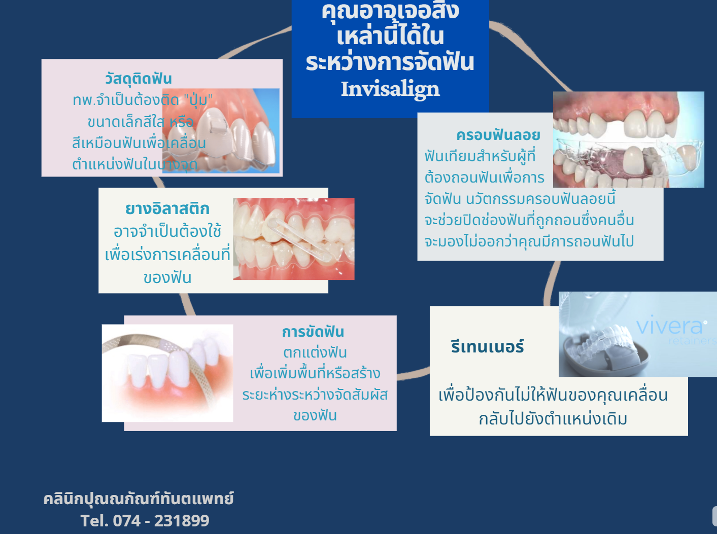 การจัดฟันใส หาดใหญ่